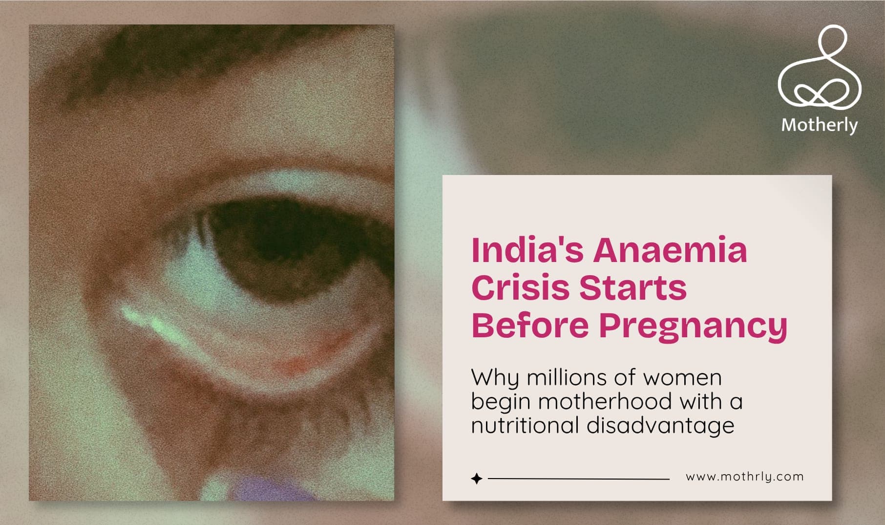 71% of Indian Women Are Anaemic Before They Get Pregnant. This Is Not a Statistic. This Is a Crisis That Is Harming Mothers and Babies Right Now.